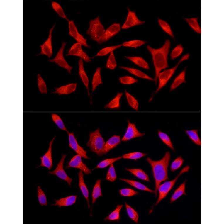 Immunofluorescence - Anti-SQSTM1 / p62 Antibody (A309479) - Antibodies.com