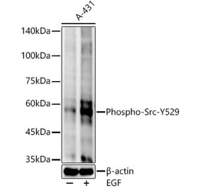 Western Blot - Anti-Src (phospho Tyr529) Antibody [ARC54665] (A309480) - Antibodies.com