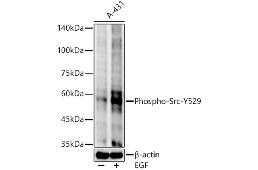 Western Blot - Anti-Src (phospho Tyr529) Antibody [ARC54665] (A309480) - Antibodies.com