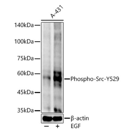 Western Blot - Anti-Src (phospho Tyr529) Antibody [ARC54665] (A309480) - Antibodies.com