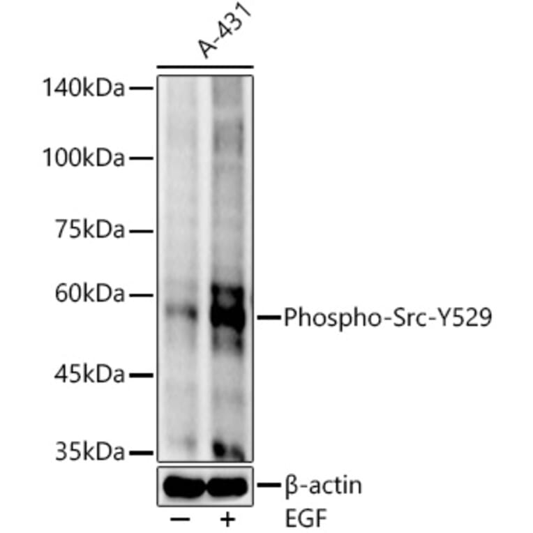 Western Blot - Anti-Src (phospho Tyr529) Antibody [ARC54665] (A309480) - Antibodies.com