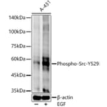 Western Blot - Anti-Src (phospho Tyr529) Antibody [ARC54665] (A309480) - Antibodies.com