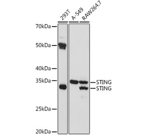 Western Blot - Anti-STING Antibody (A309483) - Antibodies.com