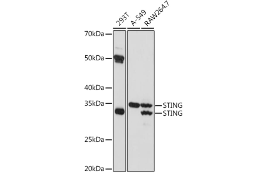 Western Blot - Anti-STING Antibody (A309483) - Antibodies.com