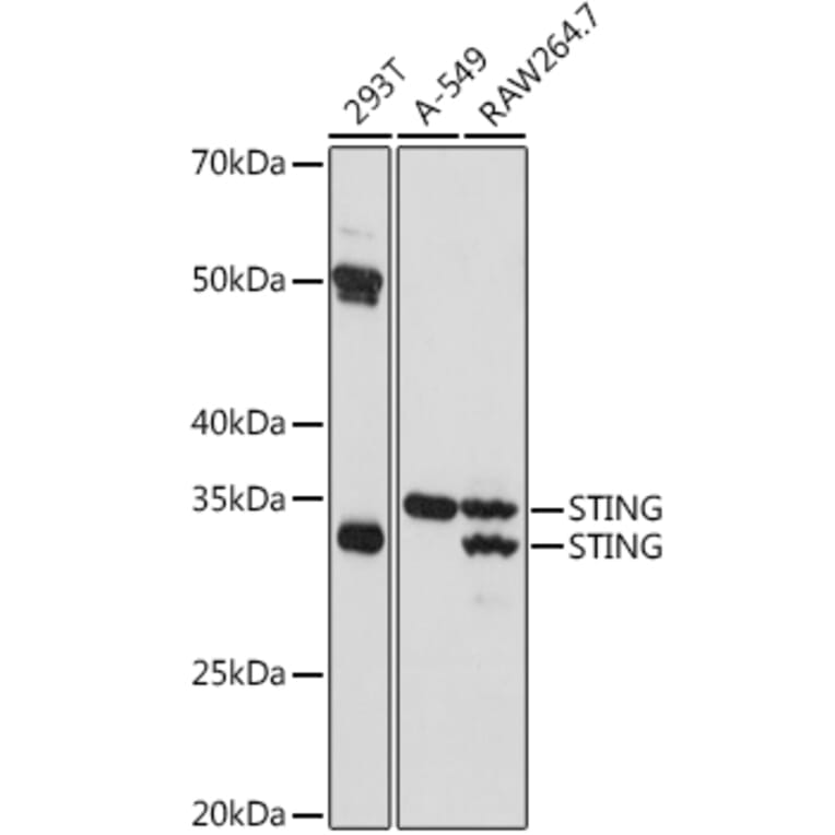 Western Blot - Anti-STING Antibody (A309483) - Antibodies.com