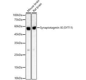 Western Blot - Anti-SYT11 Antibody [ARC59135] (A309484) - Antibodies.com