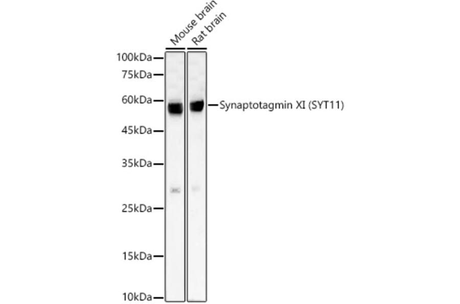 Western Blot - Anti-SYT11 Antibody [ARC59135] (A309484) - Antibodies.com
