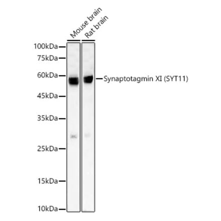 Western Blot - Anti-SYT11 Antibody [ARC59135] (A309484) - Antibodies.com