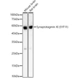 Western Blot - Anti-SYT11 Antibody [ARC59135] (A309484) - Antibodies.com