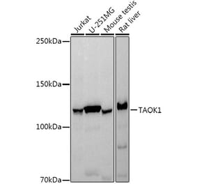 Western Blot - Anti-TAOK1 Antibody [ARC3003] (A309485) - Antibodies.com