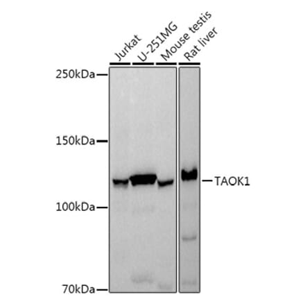 Western Blot - Anti-TAOK1 Antibody [ARC3003] (A309485) - Antibodies.com