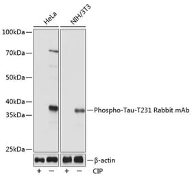 Western Blot - Anti-Tau (phospho Thr231) Antibody [ARC0021] (A309486) - Antibodies.com