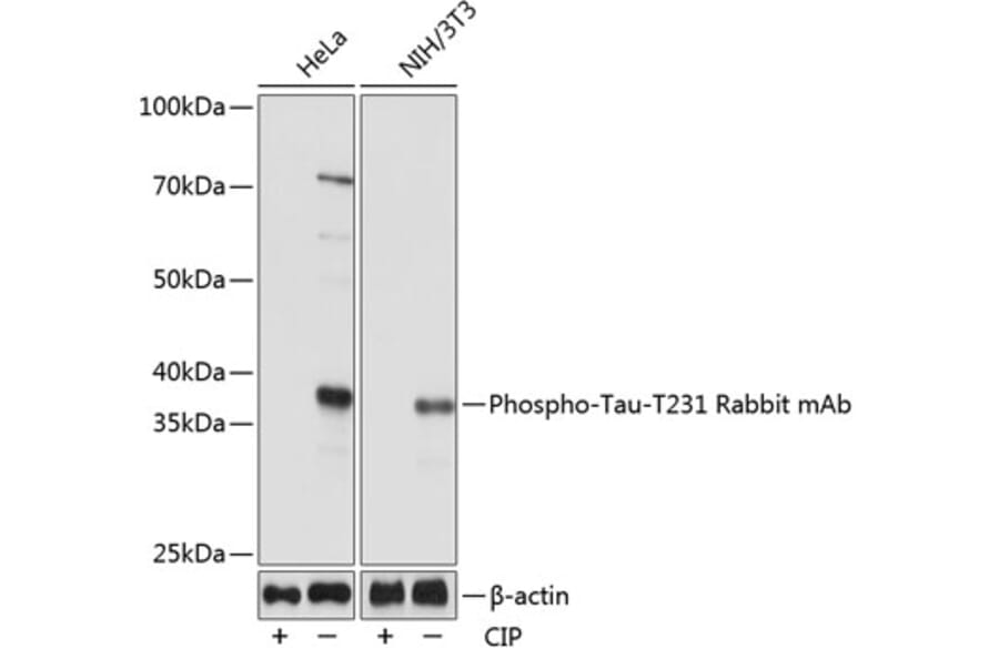 Western Blot - Anti-Tau (phospho Thr231) Antibody [ARC0021] (A309486) - Antibodies.com