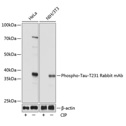 Western Blot - Anti-Tau (phospho Thr231) Antibody [ARC0021] (A309486) - Antibodies.com