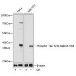 Western Blot - Anti-Tau (phospho Thr231) Antibody [ARC0021] (A309486) - Antibodies.com