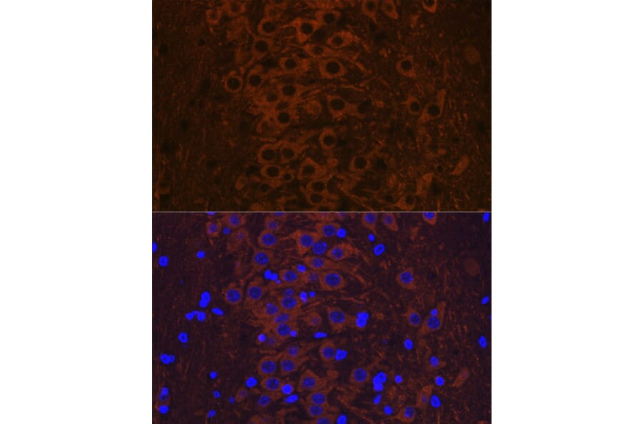 Immunofluorescence - Anti-Tau (phospho Thr231) Antibody [ARC0021] (A309486) - Antibodies.com