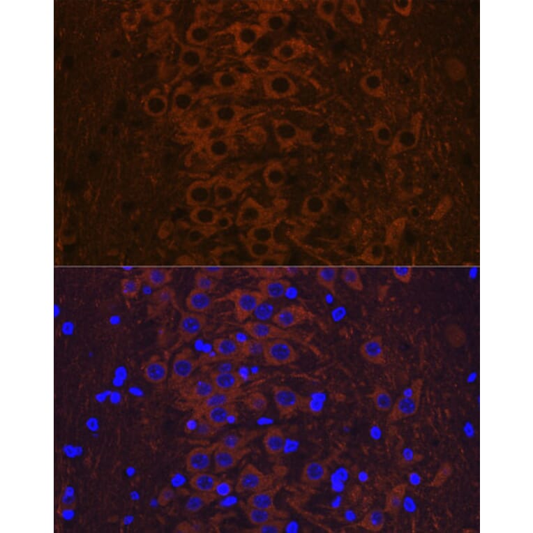 Immunofluorescence - Anti-Tau (phospho Thr231) Antibody [ARC0021] (A309486) - Antibodies.com
