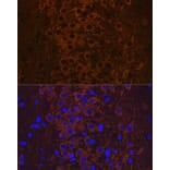 Immunofluorescence - Anti-Tau (phospho Thr231) Antibody [ARC0021] (A309486) - Antibodies.com