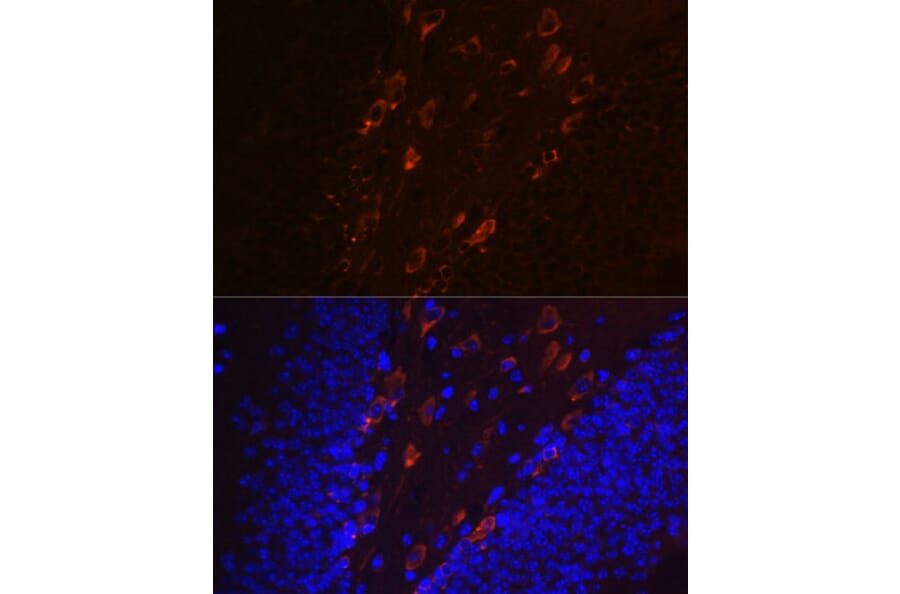 Immunofluorescence - Anti-Tau (phospho Thr231) Antibody [ARC0021] (A309486) - Antibodies.com