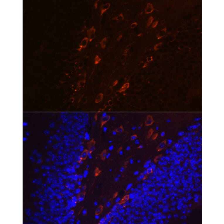 Immunofluorescence - Anti-Tau (phospho Thr231) Antibody [ARC0021] (A309486) - Antibodies.com