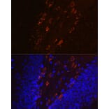 Immunofluorescence - Anti-Tau (phospho Thr231) Antibody [ARC0021] (A309486) - Antibodies.com