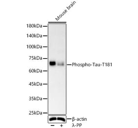 Western Blot - Anti-Tau (phospho Thr181) Antibody [ARC56528] (A309487) - Antibodies.com