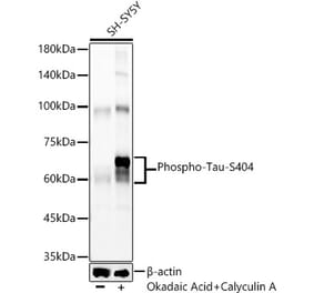 Western Blot - Anti-Tau (phospho Ser404) Antibody (A309488) - Antibodies.com