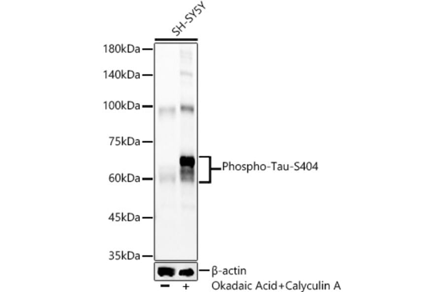 Western Blot - Anti-Tau (phospho Ser404) Antibody [ARC58154] (A309488) - Antibodies.com