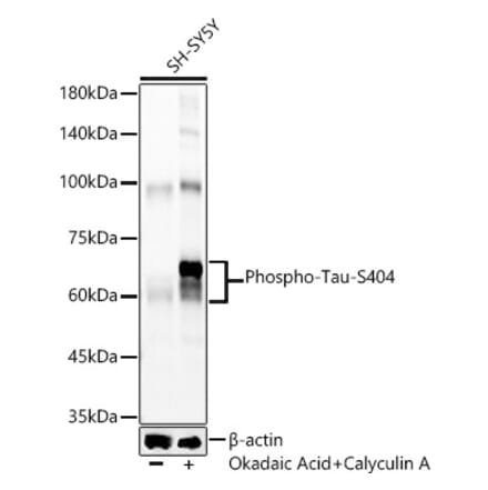 Western Blot - Anti-Tau (phospho Ser404) Antibody [ARC58154] (A309488) - Antibodies.com