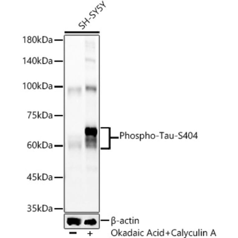 Western Blot - Anti-Tau (phospho Ser404) Antibody [ARC58154] (A309488) - Antibodies.com