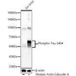 Western Blot - Anti-Tau (phospho Ser404) Antibody [ARC58154] (A309488) - Antibodies.com