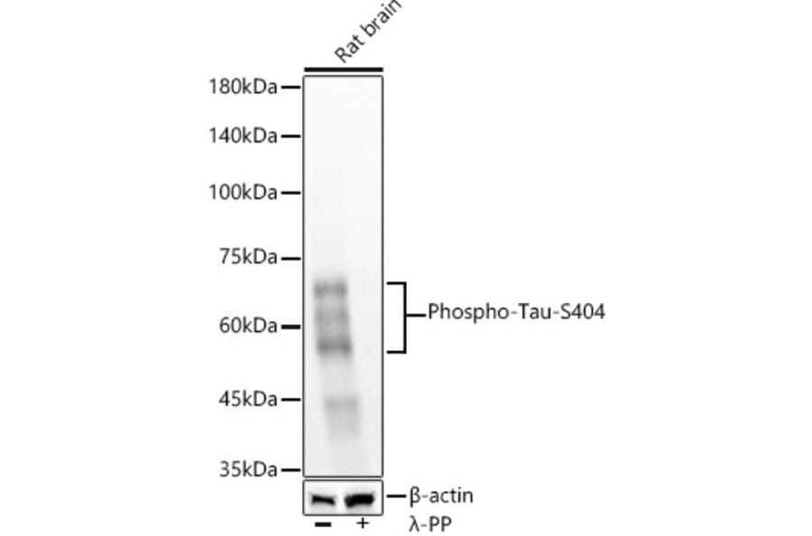 Western Blot - Anti-Tau (phospho Ser404) Antibody [ARC58154] (A309488) - Antibodies.com