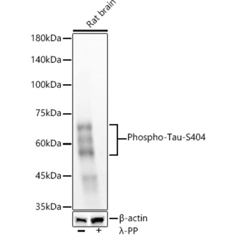 Western Blot - Anti-Tau (phospho Ser404) Antibody [ARC58154] (A309488) - Antibodies.com