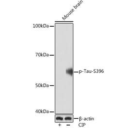 Western Blot - Anti-Tau (phospho Ser396) Antibody [ARC1573] (A309489) - Antibodies.com