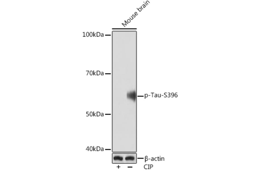 Western Blot - Anti-Tau (phospho Ser396) Antibody [ARC1573] (A309489) - Antibodies.com