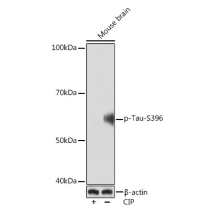 Western Blot - Anti-Tau (phospho Ser396) Antibody [ARC1573] (A309489) - Antibodies.com