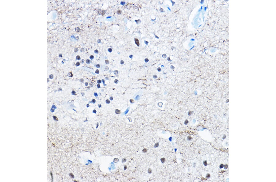 Immunohistochemistry - Anti-Tau (phospho Ser396) Antibody [ARC1573] (A309489) - Antibodies.com