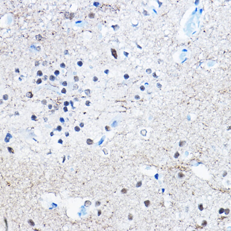 Immunohistochemistry - Anti-Tau (phospho Ser396) Antibody [ARC1573] (A309489) - Antibodies.com