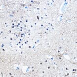 Immunohistochemistry - Anti-Tau (phospho Ser396) Antibody [ARC1573] (A309489) - Antibodies.com
