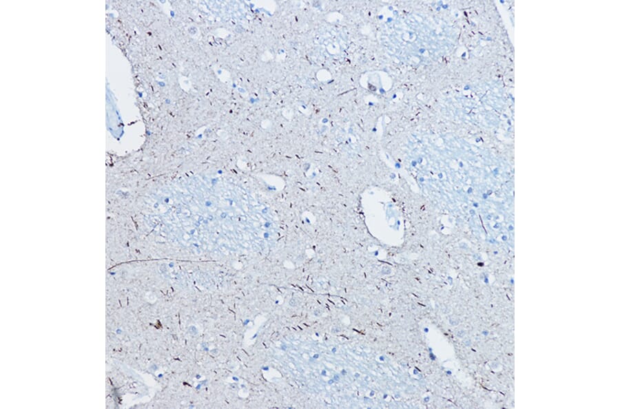 Immunohistochemistry - Anti-Tau (phospho Ser396) Antibody [ARC1573] (A309489) - Antibodies.com