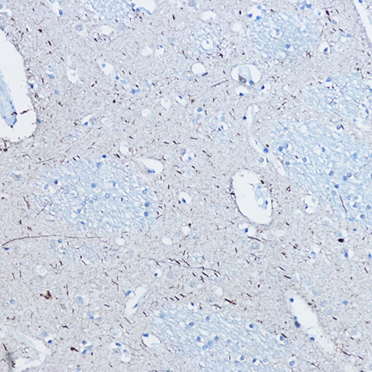 Immunohistochemistry - Anti-Tau (phospho Ser396) Antibody [ARC1573] (A309489) - Antibodies.com