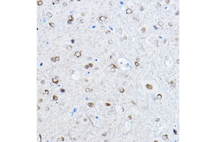 Immunohistochemistry - Anti-Tau (phospho Ser396) Antibody [ARC1573] (A309489) - Antibodies.com
