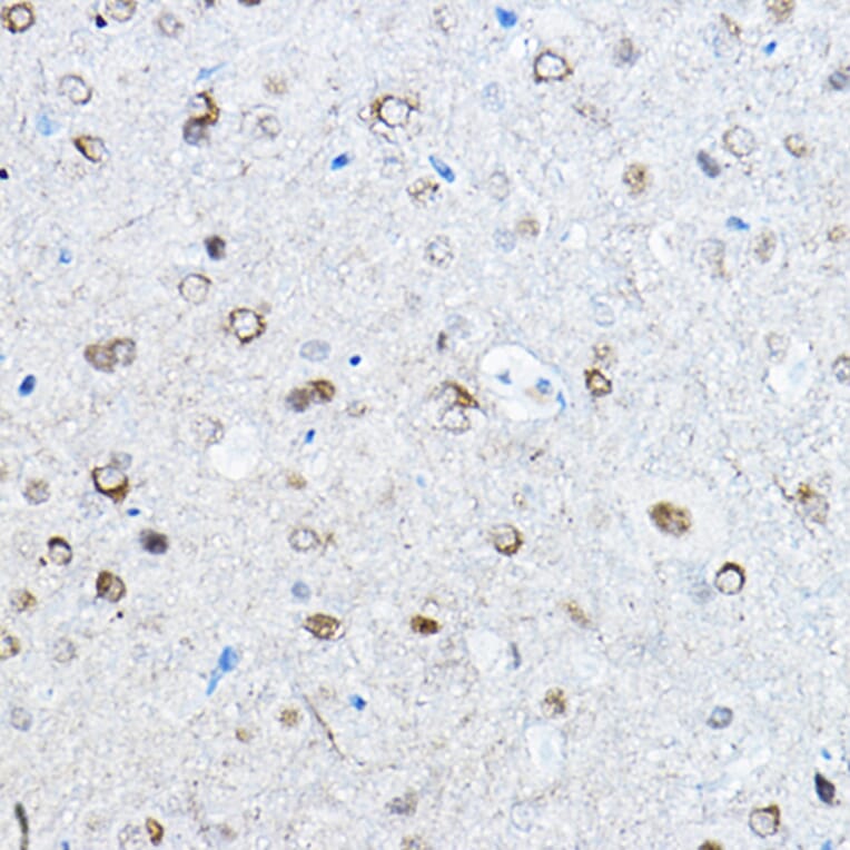 Immunohistochemistry - Anti-Tau (phospho Ser396) Antibody [ARC1573] (A309489) - Antibodies.com