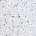 Immunohistochemistry - Anti-Tau (phospho Ser396) Antibody [ARC1573] (A309489) - Antibodies.com