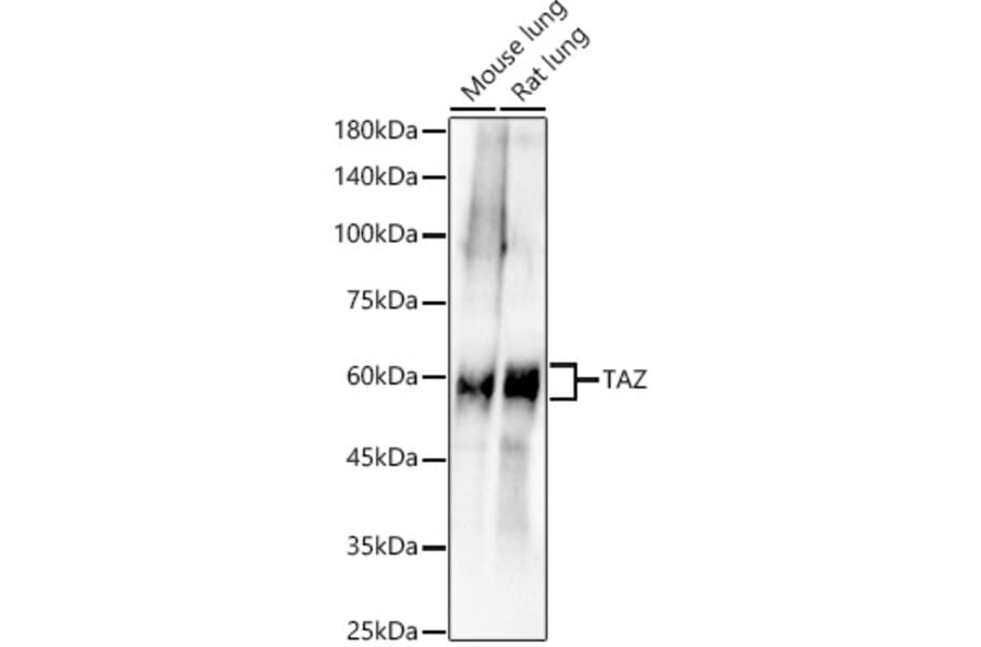 Western Blot - Anti-TAZ Antibody [ARC57803] (A309490) - Antibodies.com