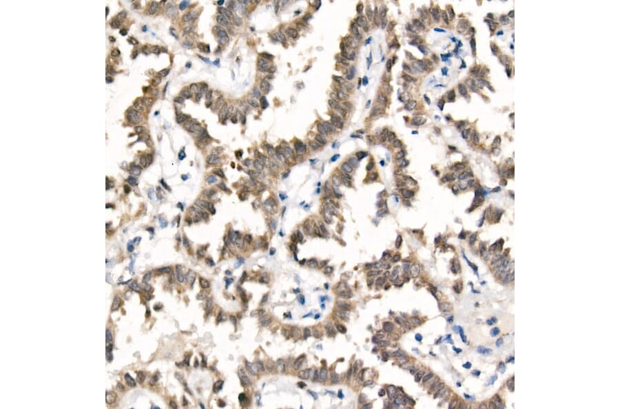 Immunohistochemistry - Anti-TAZ Antibody [ARC57803] (A309490) - Antibodies.com