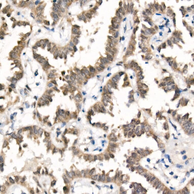Immunohistochemistry - Anti-TAZ Antibody [ARC57803] (A309490) - Antibodies.com