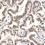 Immunohistochemistry - Anti-TAZ Antibody [ARC57803] (A309490) - Antibodies.com