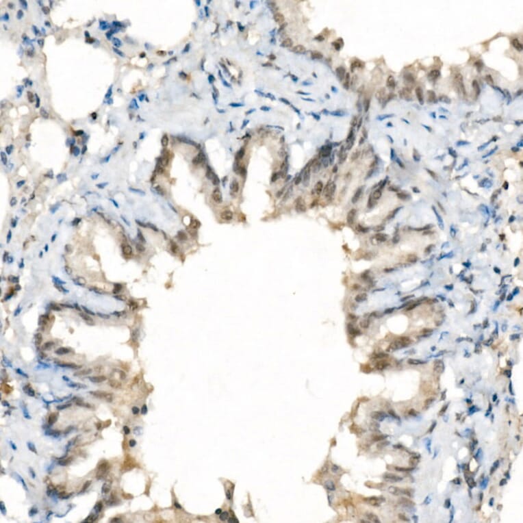 Immunohistochemistry - Anti-TAZ Antibody [ARC57803] (A309490) - Antibodies.com