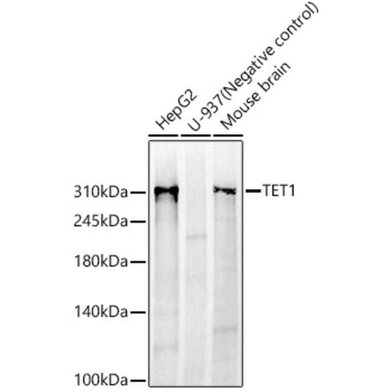 Western Blot - Anti-TET1 Antibody [ARC59030] (A309493) - Antibodies.com